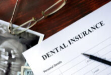 Will Insurance Cover Dental Implants? | Dentist In New Bern Nc