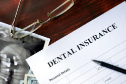 Will Insurance Cover Dental Implants? | Dentist In New Bern Nc